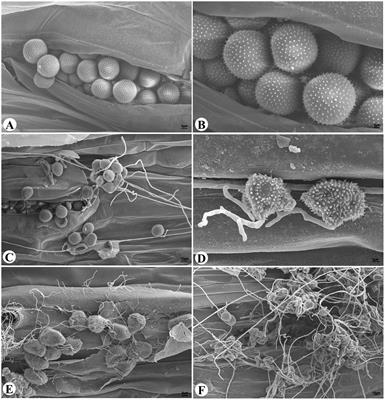 Identification of a Novel Alternaria alternata Strain Able to Hyperparasitize Puccinia striiformis f. sp. tritici, the Causal Agent of Wheat Stripe Rust